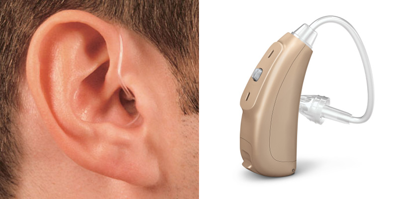 助听器配戴后的适应与保养